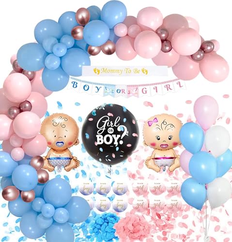 Gender Reveal Party Deko Set F R Babypartys
